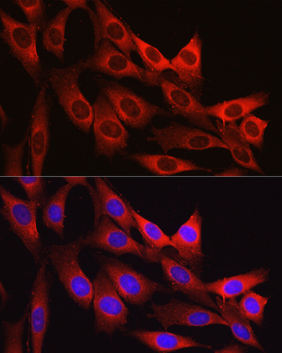 VCL Antibody