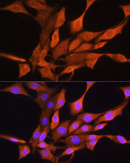 AIRE Antibody