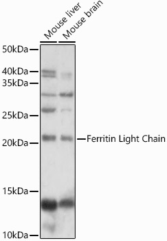 FTL Antibody