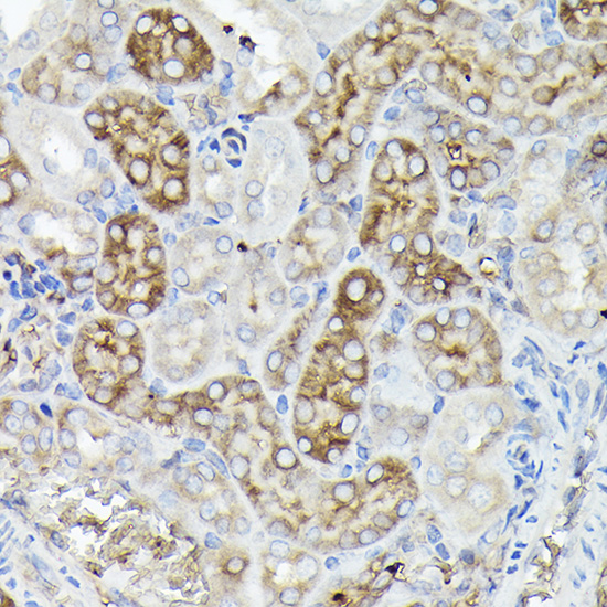 FTL Antibody