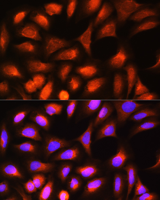 FTL Antibody