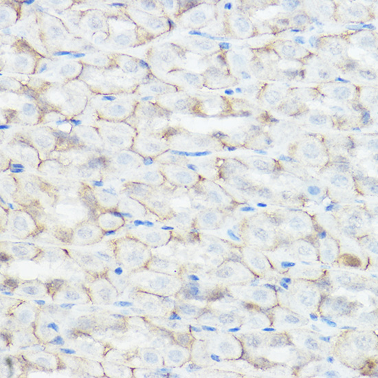 GABRA2 Antibody