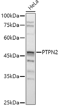 PTPN2 Antibody