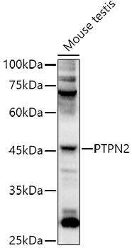 PTPN2 Antibody