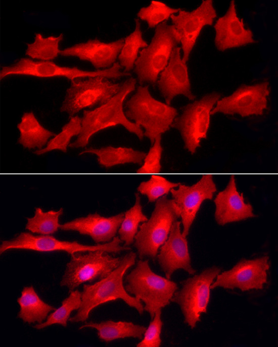 PTPN2 Antibody