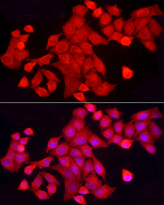 PTPN2 Antibody