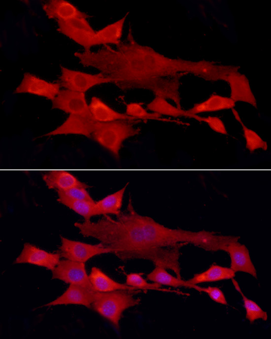 PTPN2 Antibody