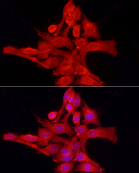 PTPN2 Antibody