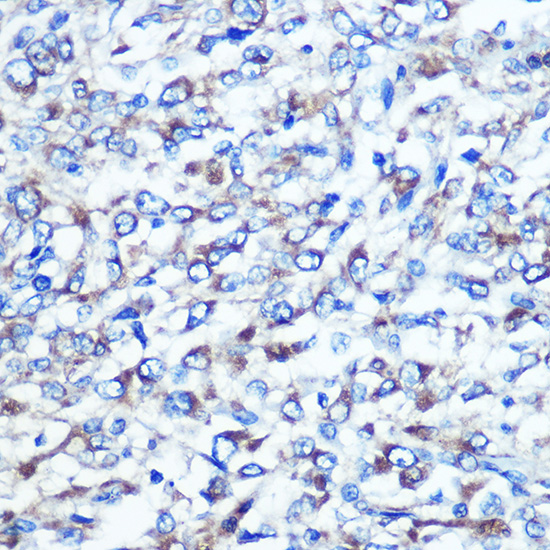 OPTN Antibody