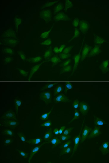 LIG1 Antibody