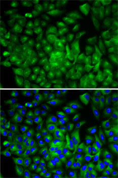 ATG16L1 Antibody