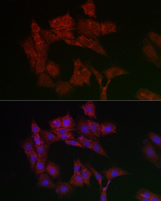 SLC25A4 Antibody