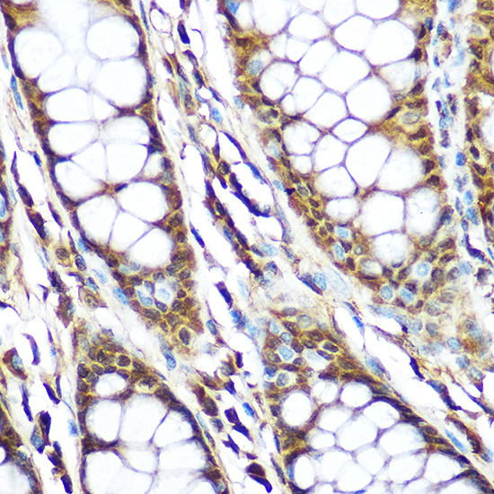 LIG3 Antibody