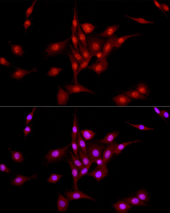 LIG3 Antibody