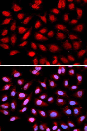 PPP2R4 Antibody