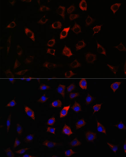 RAB27A Antibody