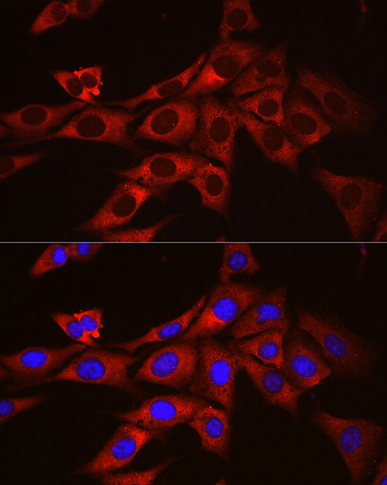 ODC1 Antibody