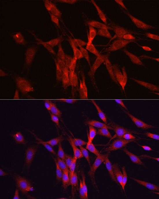 ODC1 Antibody