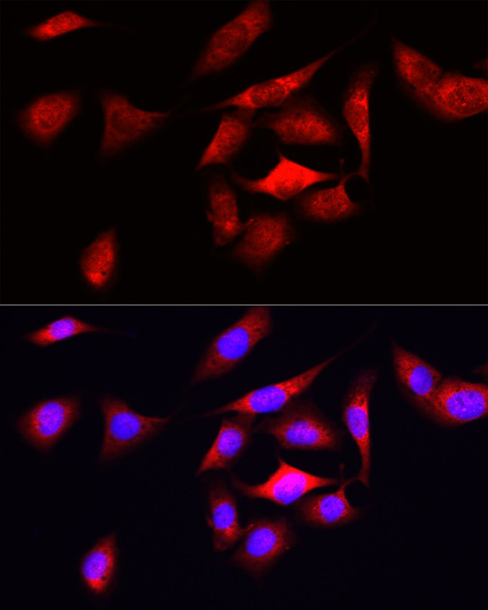 ODC1 Antibody