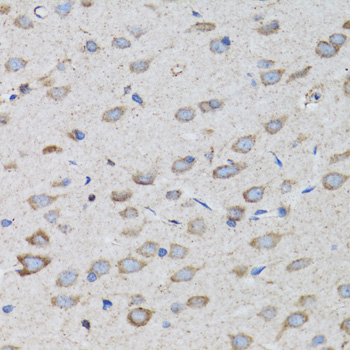 PSMD10 Antibody