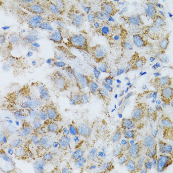 PSMD10 Antibody