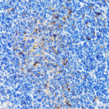 PSMD10 Antibody