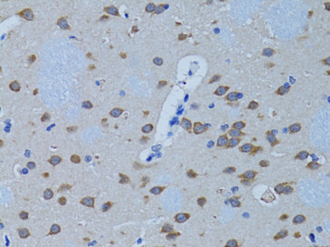 PLCB1 Antibody