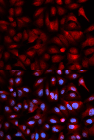 PSMB5 Antibody