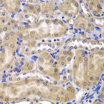 RPL5 Antibody