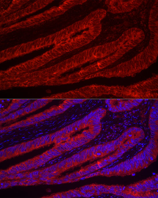 TFF3 Antibody