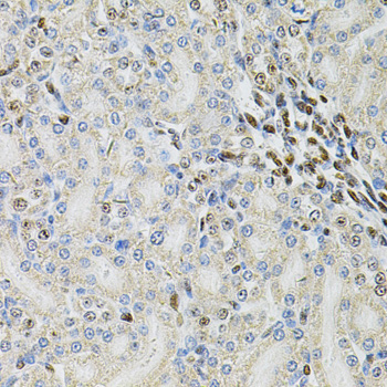 PSMC3 Antibody