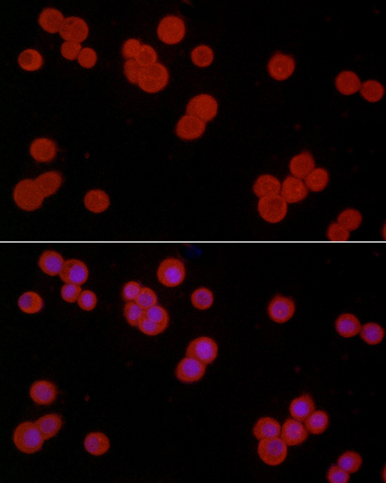 S100A10 Antibody