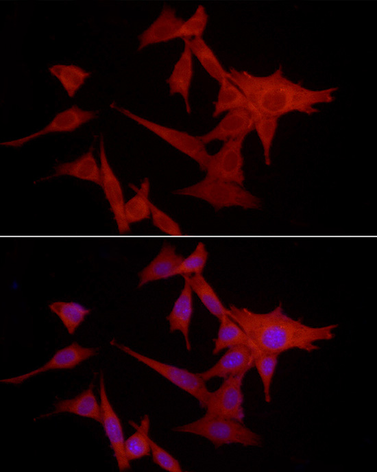 S100A10 Antibody