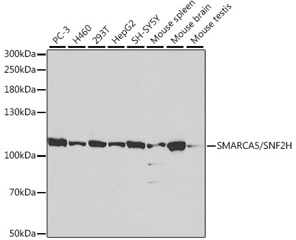 SMARCA5 Antibody