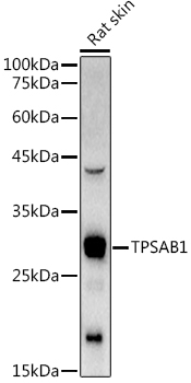 TPSAB1 Antibody