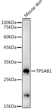 TPSAB1 Antibody