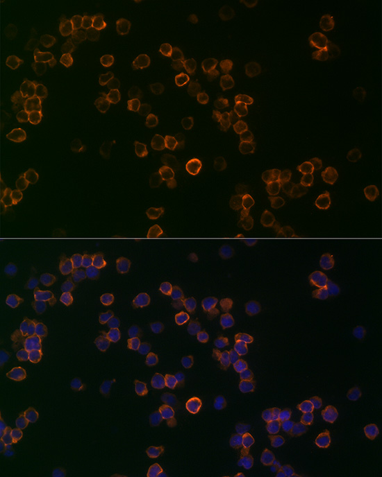 CD99 Antibody