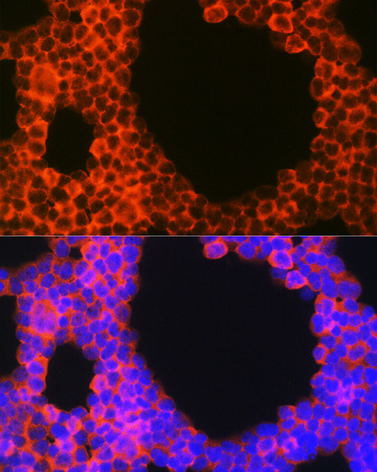 CD70 Antibody