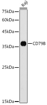 CD79B Antibody