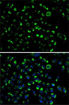 AK4 Antibody