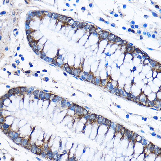 CAPZA2 Antibody