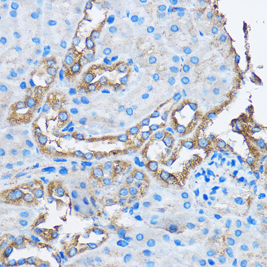 CAPZA2 Antibody