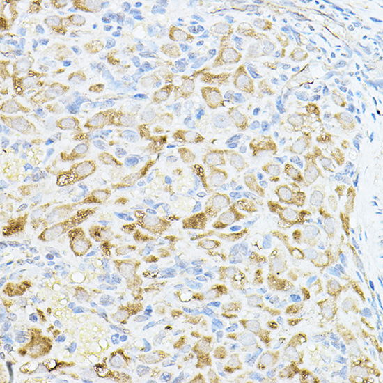 CCNB1 Antibody