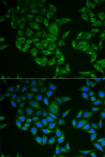 CD247 Antibody