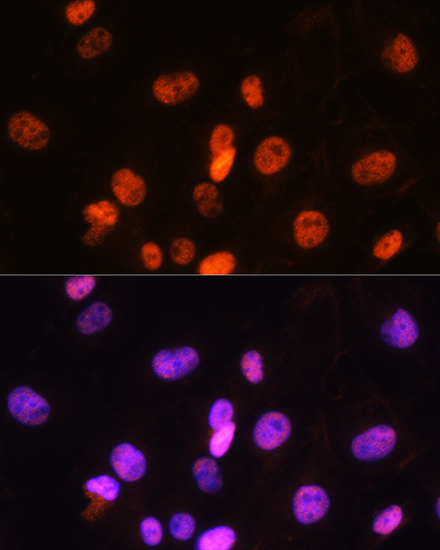 FANCD2 Antibody