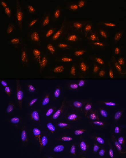 FANCD2 Antibody