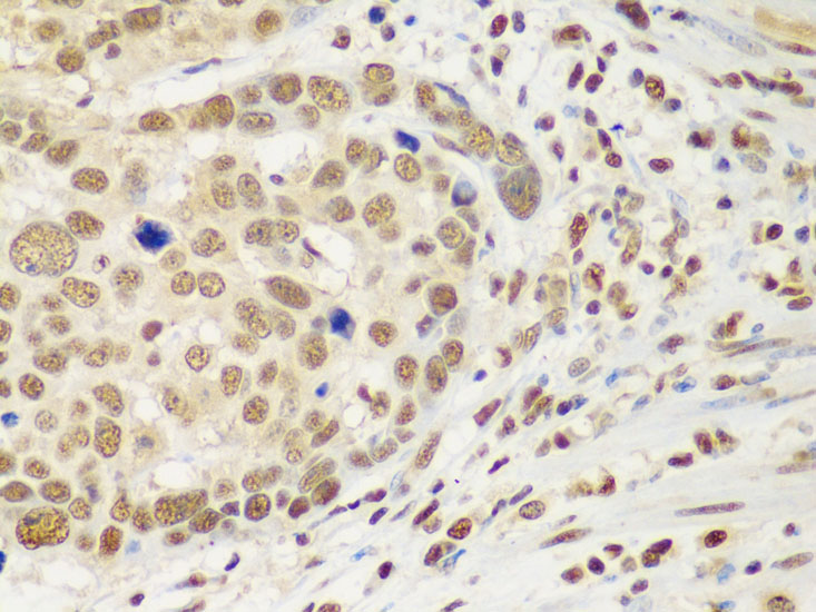 HDAC2 Antibody