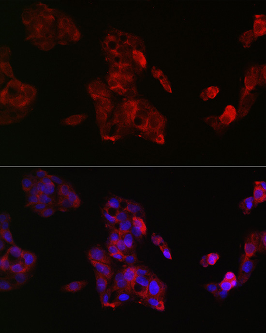 IGF2 Antibody