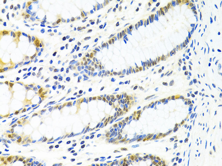 PPP4C Antibody