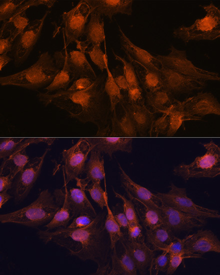 UCHL1 Antibody